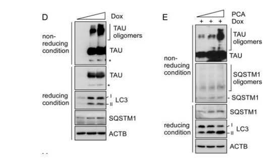 Doxycyclin과 PCA를 세포에 함께 처리한 후 타우 단백질과 자식작용 표지자들의 변화 관찰