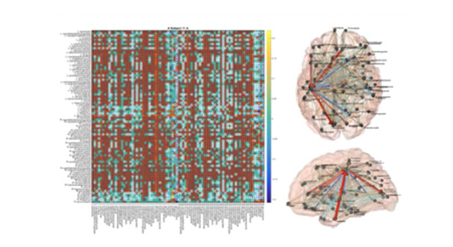 (좌) 82개 Whole Brain의 Full-connected Model을 이용한 유효인과연결망 추정, 추정단계에서 Left-hemisphere, Right-HemiSphere의 DCM 모델을 Prior로 사용하여 계산량 및 국소최저점에 빠지는 문제를 막음