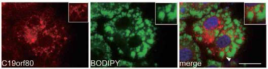 간세포 내 지방포(lipid droplet)와 Betatrophin 발현 분포의 연관성