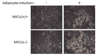 MICU1 결손에 의한 지방축적 (lipid droplet) 비교