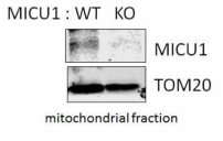 대식세포 미토콘드리아의 MICU1 발현 변화