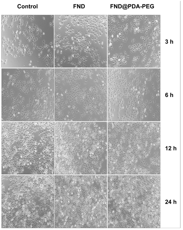 HeLa 세포에 FND와 FND@PDA-PEG를 처리한 후 incubation 시간별로 측정한 광학현미경 사진. 처리해준 나노 입자들의 농도는 50 μg/mL 이다