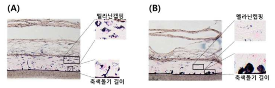 MCTT MelaskinTM을 활용한 미백시험법의 개발, Keratinocyte capping 현상 (A)대조군, (B)미백물질처치군