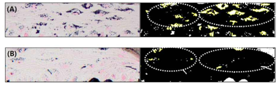 MCTT MelaskinTM을 활용한 미백시험법의 개발, Keratinocyte capping 현상의 정량화 (A)대조군, (B)미백물질처치군