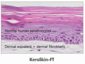피부전층모델 (Keraskin-FTTM) 구조 (출처: MCTT사)