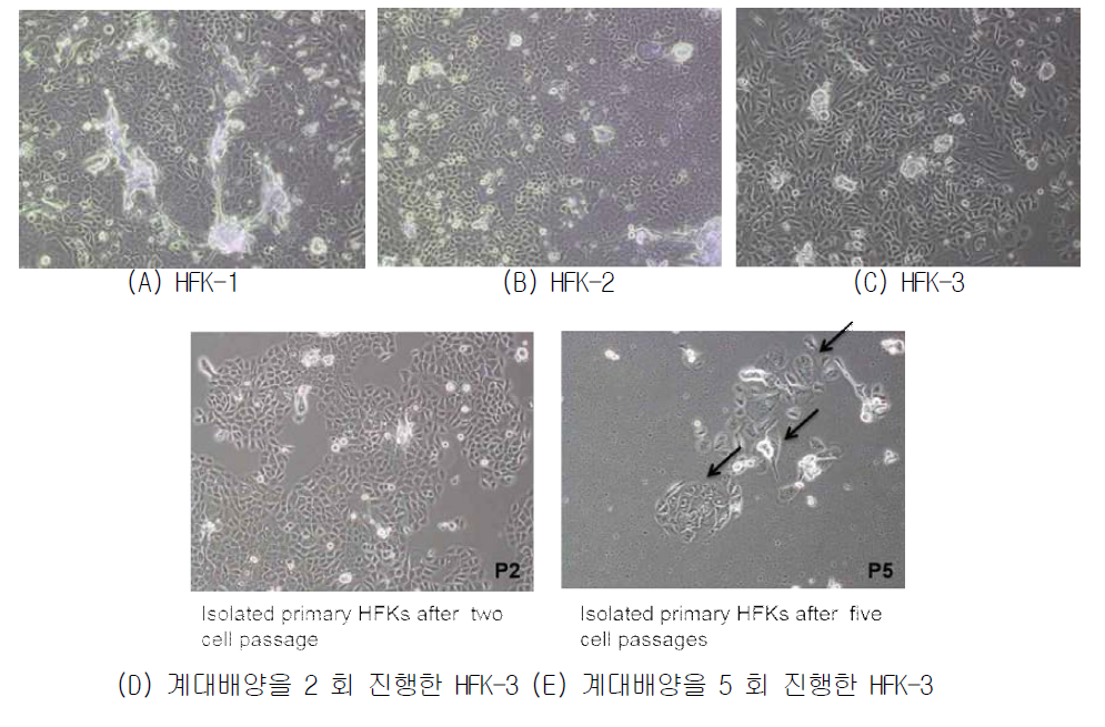 동국대학병원 비뇨기과에서 제공받은 음경포피에서 분리한 3 종의 HFK 현미경 사진(A) HFK-1 (B) HFK-2 (C) HFK-3 (D) 계대배양을 2 회 진행한 HFK-3 (E) 계대배양을 5 회 진행한 HFK-3