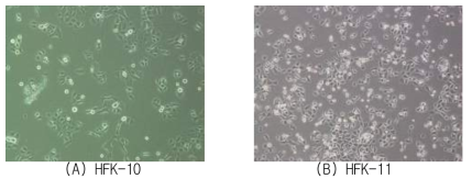 동국대학병원 비뇨기과에서 제공받은 음경포피에서 추가적으로 분리한 2 종의 HFK 현미경 사진 (A) HFK-10 (B) HFK-11