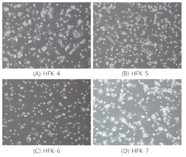 테고 사이언스에서 구입한 4 종의 HFK 현미경 사진 (A) HFK-4 (B) HFK-5 (C) HFK-6 (D) HFK-7