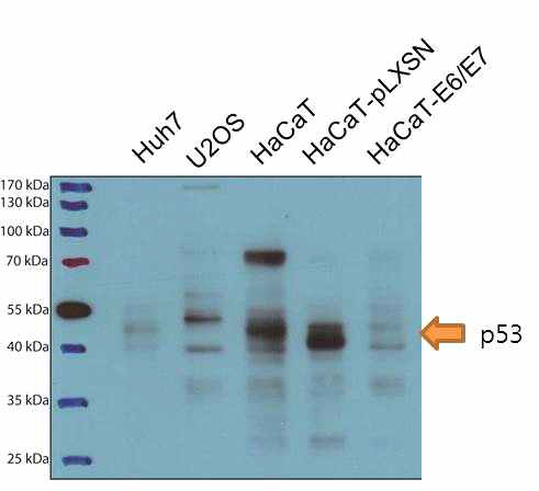 Huh7, U2OS, HaCaT, 및 HPV의 E6 및 E7을 발현하는 레트로바이러스에 감염된 HaCaT의 p53 단백질의 발현 정도
