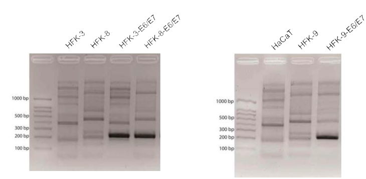 3 주의 정상 HFK (HFK-3, HFK-8, HFK-9) 와 HPV E6 및 E7을 발현하는 레트로바이러스에 감염된 HFK (HFK-3-E6/E7, HFK-8-E6/E7, HFK-9-E6/E7)에서 DNA를 추출하고 HPV E6 및 E7에 특이적인 프라이머를 이용해 PCR을 수행한 결과