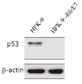 정상 HFK-9과 HPV의 E6 및 E7을 발현하는 레트로바이러스에 감염된 HFK-9(HFK-9-E6/E7)의 p53 단백질의 발현 정도를 비교한 웨스턴블롯 결과