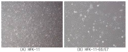 (A) 정상 HFK-11 (B) HPV E6/E7 발현 레트로바이러스 감염에 의해 영구화된 HFK-11(HFK-11-E6/E7)