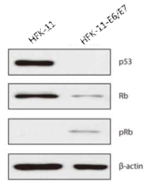 HFK-11의 영구화 전후의 p53, Rb, phospho-Rb 및 β-actin의 발현량 변화
