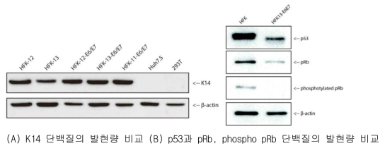 (A) 새롭게 확립된 영구화 각질세포주(HFK-12-E6/E7, HFK-13-E6/E7)의 cytokeratin 14 (K14)의 단백질 발현량을 웨스턴블롯으로 비교한 데이터. K14 단백질이 발현 되지 않는 간암세포주인 Huh7.5와 kidney 세포주인 293T를 negative control로 사용함. (B) 새롭게 확립된 영구화 각질세포주(HFK-13-E6/E7)의 E6와 E7 단백질의 발현을 확인하기 위해 세포내의 p53과 pRb, 그리고 인산화된 pRb의 양을 웨스턴블롯으로 비교한 데이터