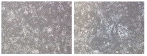 영구화된 각질세포(HFK-11-E6/E7)와 마우스 섬유아세포(NIH3T3)와의 공배양 사진. 콜로니형태를 이루어 함께 자라고 있는 것이 영구화된 각질 세포이고 길게 찢어진 형태가 마우스 섬유아세포임