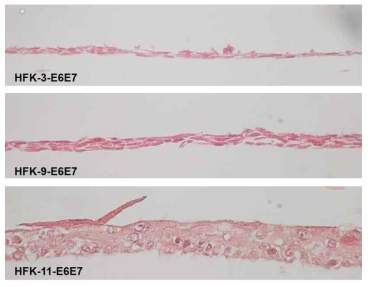 인유두종 바이러스의 암화 단백질 E6와 E7을 발현하는 영구화된 각질세포주를 이용한 피부전층모델의 모식도 및 영구화된 3종의 각질 세포주(HFK-3-E6/E7, HFK-9-E6/E7, HFK-11-E6/E7)을 3 차원 피부배양 후 H/E 조직 염색한 결과