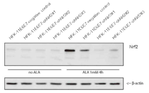 HFK-11-E6E7-negative control 세포주와 Nrf2 knock-down 시킨 HFK-11-E6E7 세포주에 Nrf2 inducer인 alpha lipoic acid 처리 후 웨스턴블롯을 통해 정량한 Nrf2 및 β-actin의 양을 비교한 실험