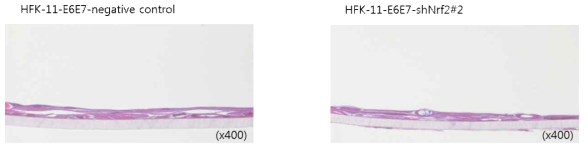 영구화된 HFK-11-E6E7-negative control 세포주와 Nrf2가 knock-down된 HFK-11-shNrf2#2 세포주를 사용해 진피층이 없는 상태에서 3 차원 배양한 결과