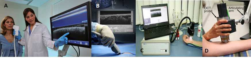 A. Michelson diagnostics사의 피부과 진단 의료장치, B. 암진단을 위한 수술용 손잡이형 프로브[1], C,D. 범용 OCT장비를 이용한 피부정량화 연구관련 사진[2,3]