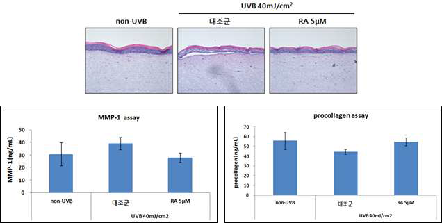 UVB 자극을 통한 인공피부 모델의 생리학적 인체 상관성 검증