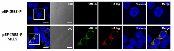 MLL5 유전자를 삽입한 pEF-IRES-P 플라즈미드을 293T 세포에 Transfection시켜 발현여부를 확인함