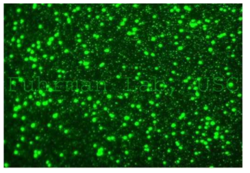 SYBR 염색된 박테리아(큰 개체), 바이러스(작은 개체), Fuhrman web page 인용