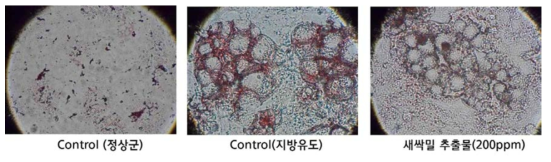 새싹밀 추출물의 지방세포 Oil-red staining 현미경 사진 결과