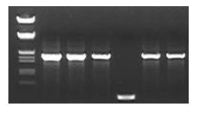 T7과 M13R primer를 이용한 insert check 결과