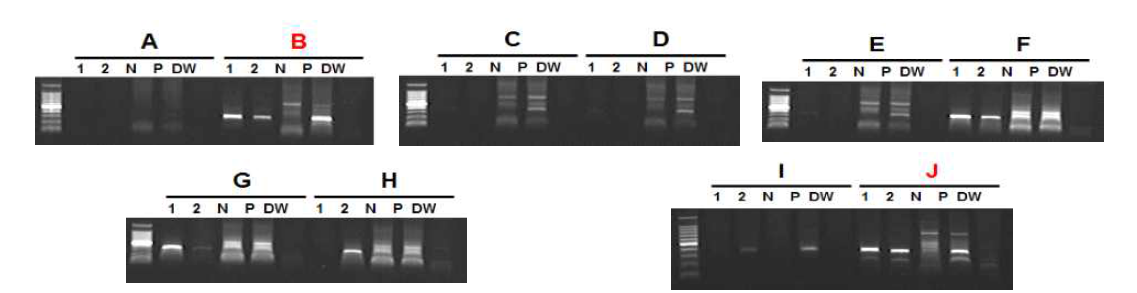 각 조건에 따른 Direct Micro-Tissue RT-PCR 검정 결과 비교 (A) 10 mM dNTP 1μl, Oligo dT primer 1μL (B) 10 mM dNTP 1μL, Primer-For 1μL (c)2.5 mM dNTP 1μL, Oligo dT primer 1μL (D) 2.5 mM dNTP 1μL, Oligo dT primer 0.75μL (E) 2.5 mM dNTP 1μL, Oligo dT primer 0.5μL (F) 2.5 mM dNTP 1μL, Primer-For 1μL (G) 2.5 mM dNTP 1μL, Primer-For 0.75μL (H) 2.5 mM dNTP 1μL, Primer-For 0.5μL (I) 2.5 mM dNTP 4μL, Oligo dT primer 1μL (J) 2.5 mM dNTP 4μL, Primer-For 1μL