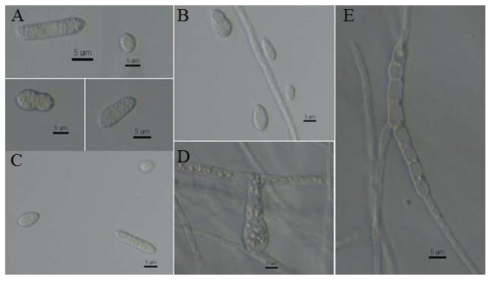 PDA 배지에서 배양된 Cylindrocarpon destructans 포자 및 균사 형태 관찰. A-C: 소형포자, D-E: 균사