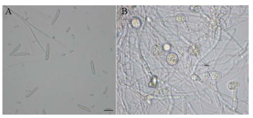 V8 Juice Agar 배지에서 배양한 Cylindrocarpon destructans의 분생 포자 및 후벽포자. A: 분생포자 (대형포자, 소형포자), B: 후벽포자