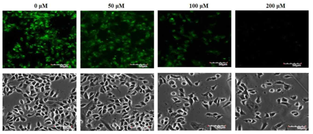 The effect of formaldehyde on MMP in SK-N-SH cells. SK-N-SH cells were treated with 50-R200 μM formaldehyde or left untreated for 24 h. Collapse of the MMP in cells was detected by confocal laser scanning microscopy using rhodamine123 staining. The lower panels show the phase contrast images of the respective fluorescent pictures. Magnification scale, 50 μm