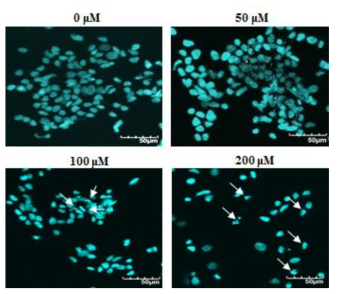 The effect of formaldehyde on chromatin fragmentation in SK-N-SH cells. Apoptosis was detected using Hoechst 33258 dye staining of 50-200 μM formaldehyde-exposed SK-N-SH cells. Nuclear damage in 24-h formaldehyde-treated cells was detected by confocal laser scanning microscopy. Arrows indicated condensed or fragmented nuclei. Scale bar, 20 μm (A). Apoptotic rate was determined by scoring the percentage of cells containing fragmented nuclei with the total number of cells. Data are presented as mean ± S.D. of three independent experiments. Asterisk (*) denotes significant differences relative to control (p < 0.05) (B)