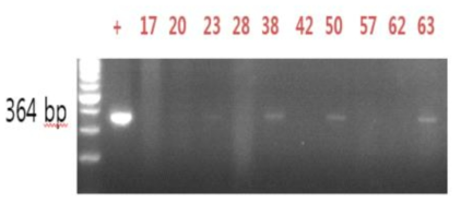 패류의 genomic DNA를 대상으로 간질충의 nuclear ribosomal internal transcribed spacer 2 (ITS-2, 우) 유전자 검출을 위한 PCR 결과. Lane 1, 100 bp marker; lane 2, positive control (adult F. hepatica worm); lanes 3-10, 채취한 패류 DNA