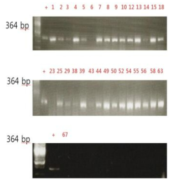 패류의 genomic DNA를 대상으로 간질충의 nuclear ribosomal internal transcribed spacer 2 (ITS-2, 우) 유전자 검출을 위한 PCR 결과. Lane 1, 100 bp marker; lane 2, positive control (adult F. hepatica worm); lanes 3-15, 채취한 패류 DNA