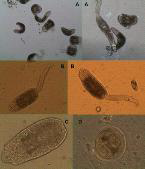 Cercariae shed from freshwater snails collected from the water stream and rice paddy in Sejong and Daejeon Yuseong-gu. A, cercariae of Metagonimus species × 100 and × 200; B cercaria of Echinostoma species × 100; C, cercaria of Paragonimus species × 200; D, metacercaria of unidentified