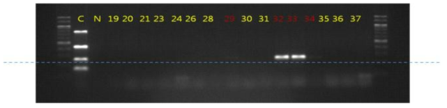 오디 및 재배환경에서 분리된 대장균(E. coli)에 대한 병원성 유전자의 PCR 패턴
