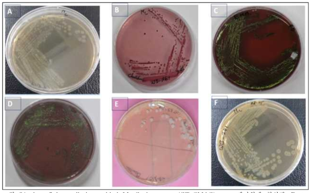 A. cefixime tellurite sorbitol MacConkey agar (CT-SMAC) agar 배지위에 형성된 Rattus norvegicus 배설물 배양액으로부터의 Sorbitol negative colonies (white color or off white color). B. CT-SMAC agar 배지위에 형성된 H inermis 배설물 배양액으로부터의 Sorbitol positive colonies (pink or red color). C. Eosin Methylene Blue Agar (EMB) 배지위에 형성된 C. capreolus 배설물 배양액으로 부터의 Escherichia coli positive colonies (metallic sheen color). D. TSA agar media위에 형성된 고라니(H.inermis) 배설물 배양액으로부터의 E. coli 콜로니. E. CT-SMAC agar streak plate위에 형성된 멧돼지(Sus scorma)배설물 배양액으로부터의 콜로니들. F. EMB위에 형성된 표준균주 E.coli_NCCP-14034에서 온 E. coli positive colonies (metallic sheen color)