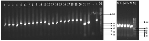 HVR primer set(V1SF PCR mixture without genomic DNA of samples =negative control (-). Only a single pure colony of all 26 positive E. coli individuals was used for PCR amplification. Gel lane No.1= MuApAg-7; No.2= MuApAg-10; No.3= MuApAg-11; No.4= MuApAg-12; No.5= MuApAg-13; No.6= MuApAg-14; No.7= MuApAg-15; No.8= MuApAg-16; No.9= MuApAg-17; No.10= MuApAg-18; No.11= MuApAg-19; No.12= MuApAg-20; No.13= MuApAg-22 ; No.14= MuApAg-23; No.15= MuApAg-24; No.16= MuApAg-25; No.17=MuApAg-26; No.18= MuApAg-27; No.19= MuApAg-28; No.20= MuApPe-1; No.21= MuApSy-1; No.22= MuApSy-2; No.22= MuApSy-2; No.23= MuApSy-3; No.24=CrMyRe-3; No.25= NuRaNo-1; No.26= NuRaNo-3