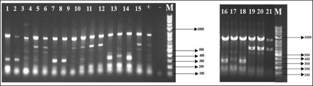 PCR amplification of Shiga toxin gene from STEC colonies using STEC-specific Stx 1 primer set. One or more pure colonies were randomly selected from all of 18 positive individuals. Two single colonies (Lane No.5 and 6 from MuRaNo-1 and three single colonies (Lane No. 15, 16 and 17) from MuApSy-3 and a single colonies from each of the rest samples. Genomic DNA of E. coli 0157:H7 (NCPP: 15739) used as positive control (+) and PCR mixture as negative control (-). PCR band ‘M’ indicate DNA 100bp marker (More than 1Kb ladder plus), The gel lane numbers are as follows: No.1= MuApAg-18; No.2= MuApAg-19; No.3=MuApSy-1; No.4= MuApSy-2; No.5= MuRaNo-1; No.6= MuRaNo-1; No.7= MuRaNo-3; No.8= MuApAg-11;No.9= MuApAg-12; No.10= MuApAg-7; No.11= MuApAg-13; No.12= MuApAg-23; No.13= MuApAg-28; No.14=CrMyRe-3; No.15=MuApSy-3; No.16=MuApSy-3; No.17=MuApSy-3; No.18=MuApAg-14; No.19=MuApAg-15; No.20=MuApAg-16, No.21=MuApAg-17