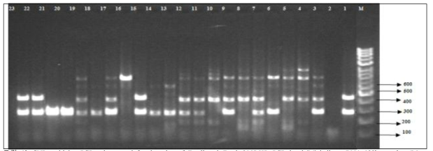 SNP multiplex PCR primer used for detection of E.coli and E.coli 0157:H7. PCR band