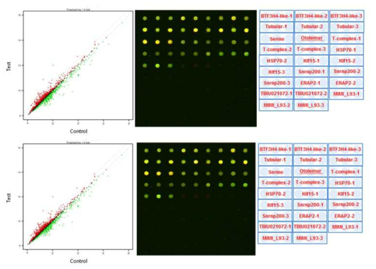 cDNA customized chip array 결과