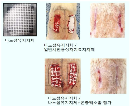 화상치료에 있어서 엑소좀의 graft능 시험