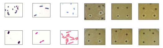 Microscopic observation & Antibiotic susceptibility of isolates