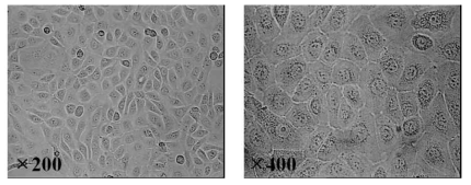 Morphology of HaCaT cells (human keratinocytes)