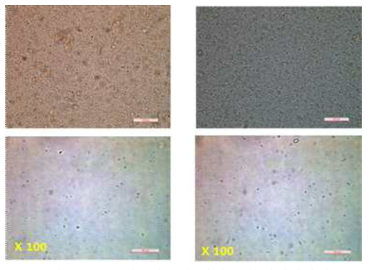 호기소화조내 미생물의 현미경사진 (위는 원액, 아래는 100배 희석)