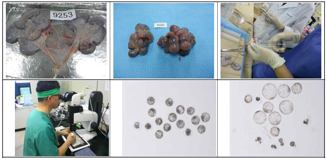 자궁 관류에 의해 채취된 체내 수정란