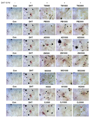 모모세포에 DHT와 곤충 추출물 동시 처리 시 지질생성 억제 확인 TM: 갈색거저리, PB: 흰점박이꽃무지, AD: 갈색거저리, MO: 애매미탈피각, HI: 동애등에, CJ: 물방개, ZM: 슈퍼밀웜