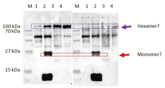 Western blot to check specific affinity of our designed antibody to PgCENH3. Once purified, it can then be used for immunodetection using cytogenetic techniques