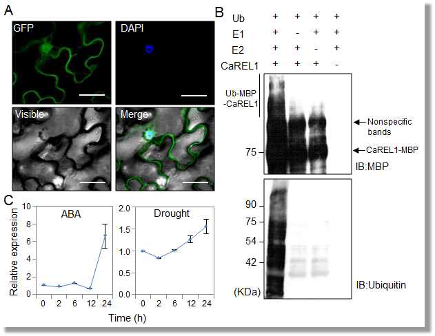 CaREL1 is localized at nucleus and has E3 ligase activity